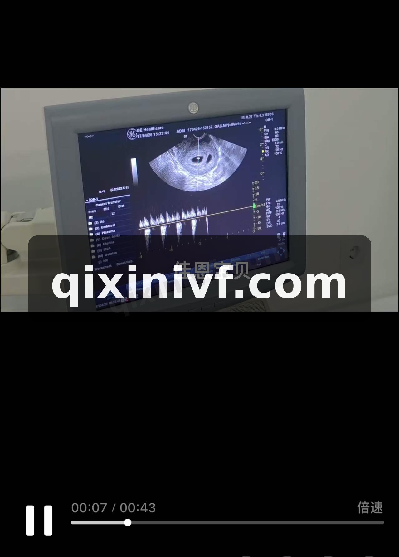 六周检查了,医生说非常好
